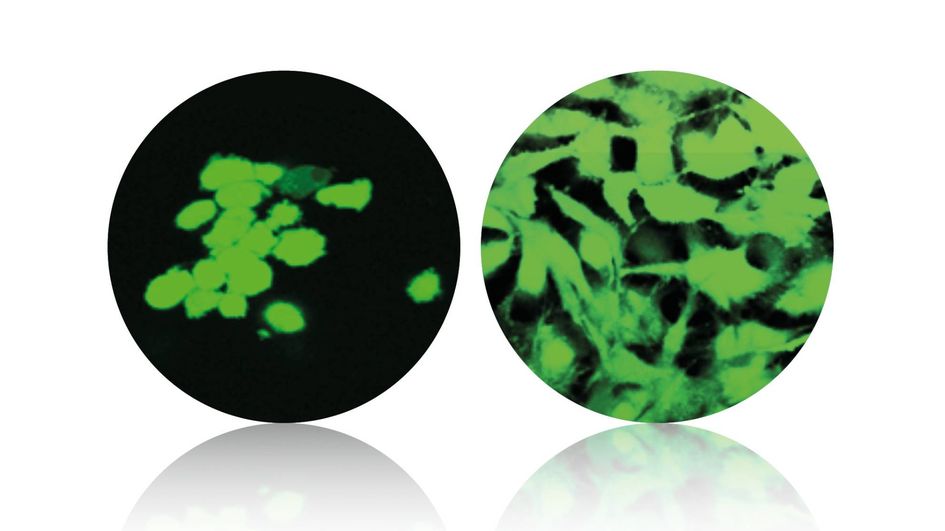 左图，VESTAKEEP® 纯PEEK表面的细胞附着；右图，VESTAKEEP® Fusion表面的细胞附着。