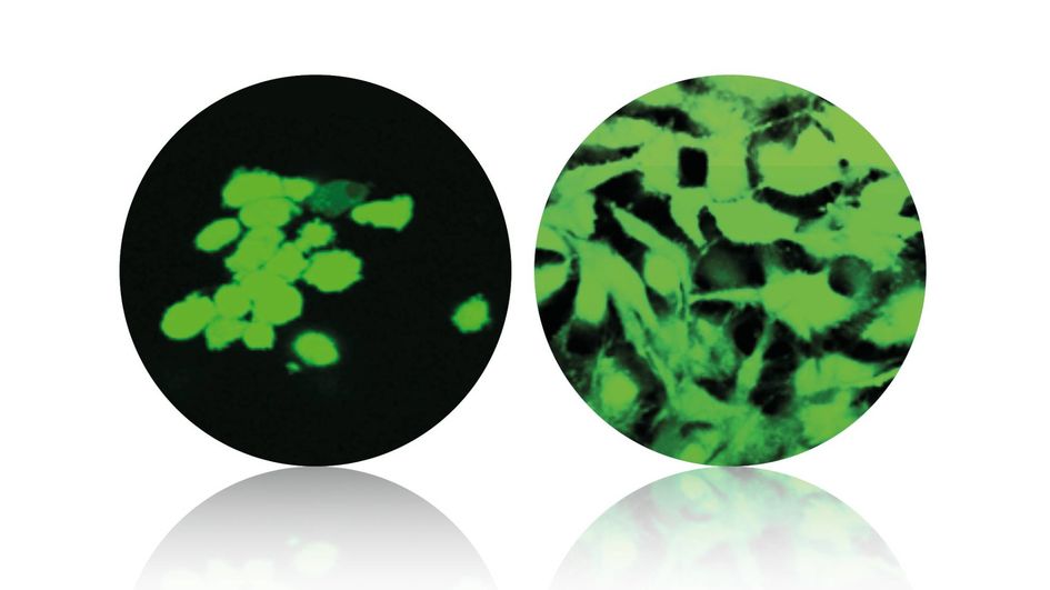 左图，纯VESTAKEEP® PEEK表面的细胞附着；右图，VESTAKEEP® Fusion表面的细胞附着。